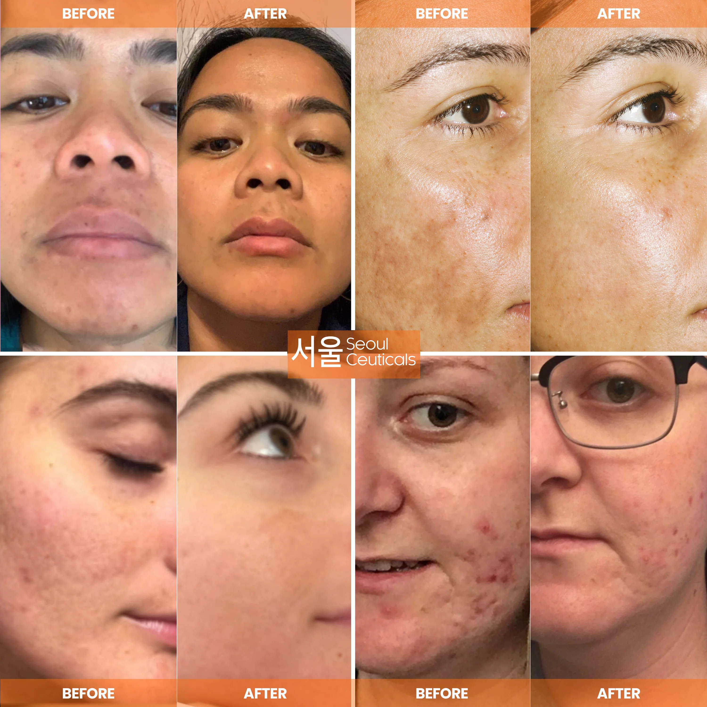 Day Glow Vitamin C Serum - Image 4